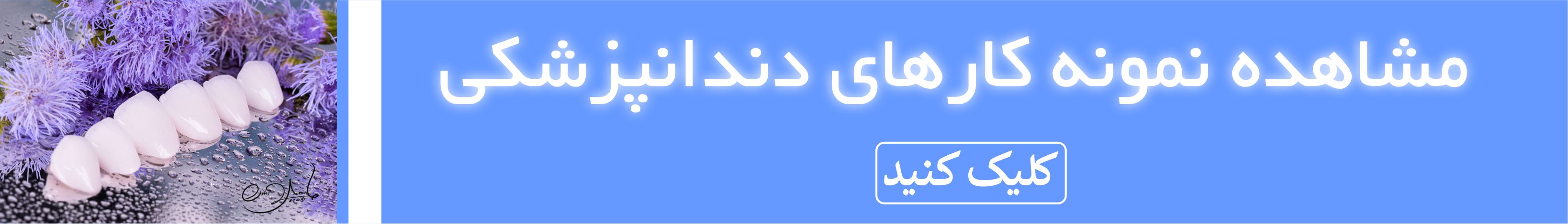 نمونه کارهای دندانپزشکی